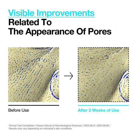 BHA 2% Gentle Exfoliating Toner